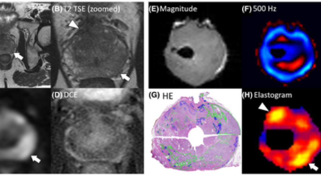 Prostate scan images