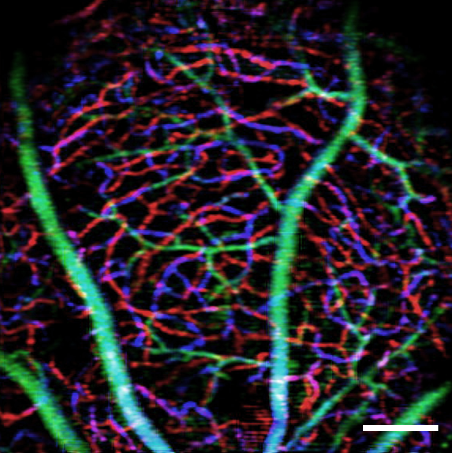 Microvascular network