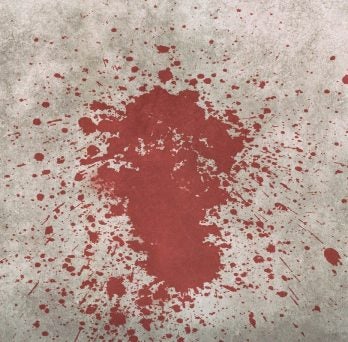 blood back spatter 