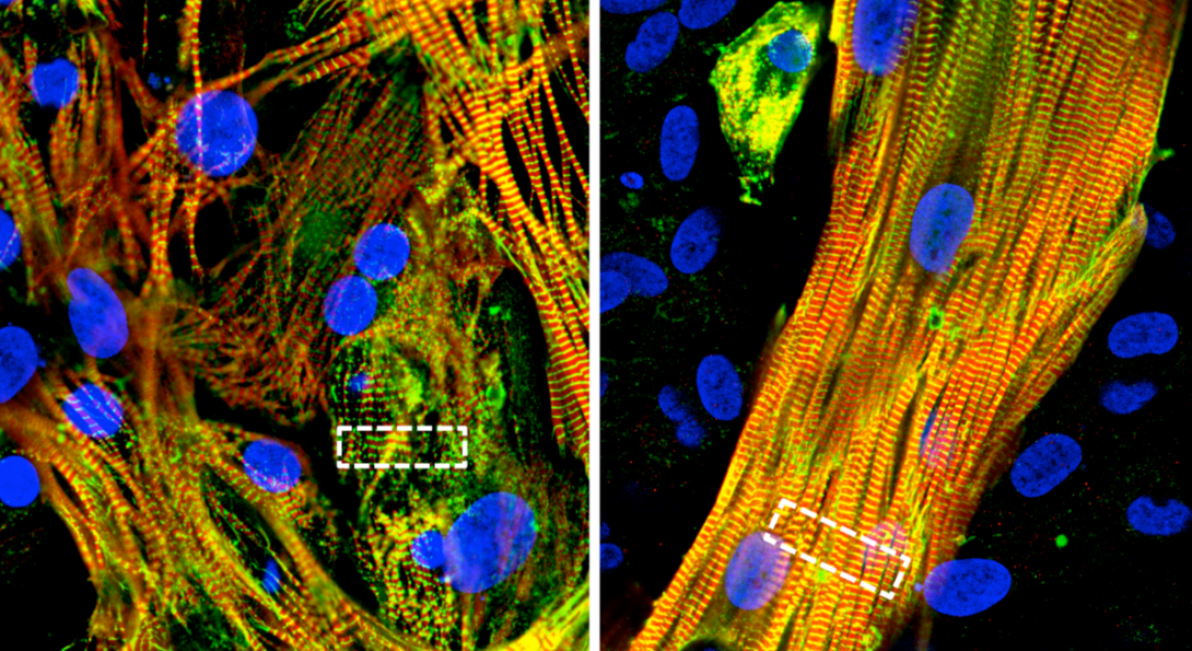 Micropatterned cultures of atrial stem cells and fibroblasts (right) spontaneously formed muscle-like structures, unlike unpatterned cultures of stem cells alone (left).