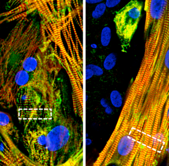 Micropatterned cultures of atrial stem cells and fibroblasts (right) spontaneously formed muscle-like structures, unlike unpatterned cultures of stem cells alone (left).
                  