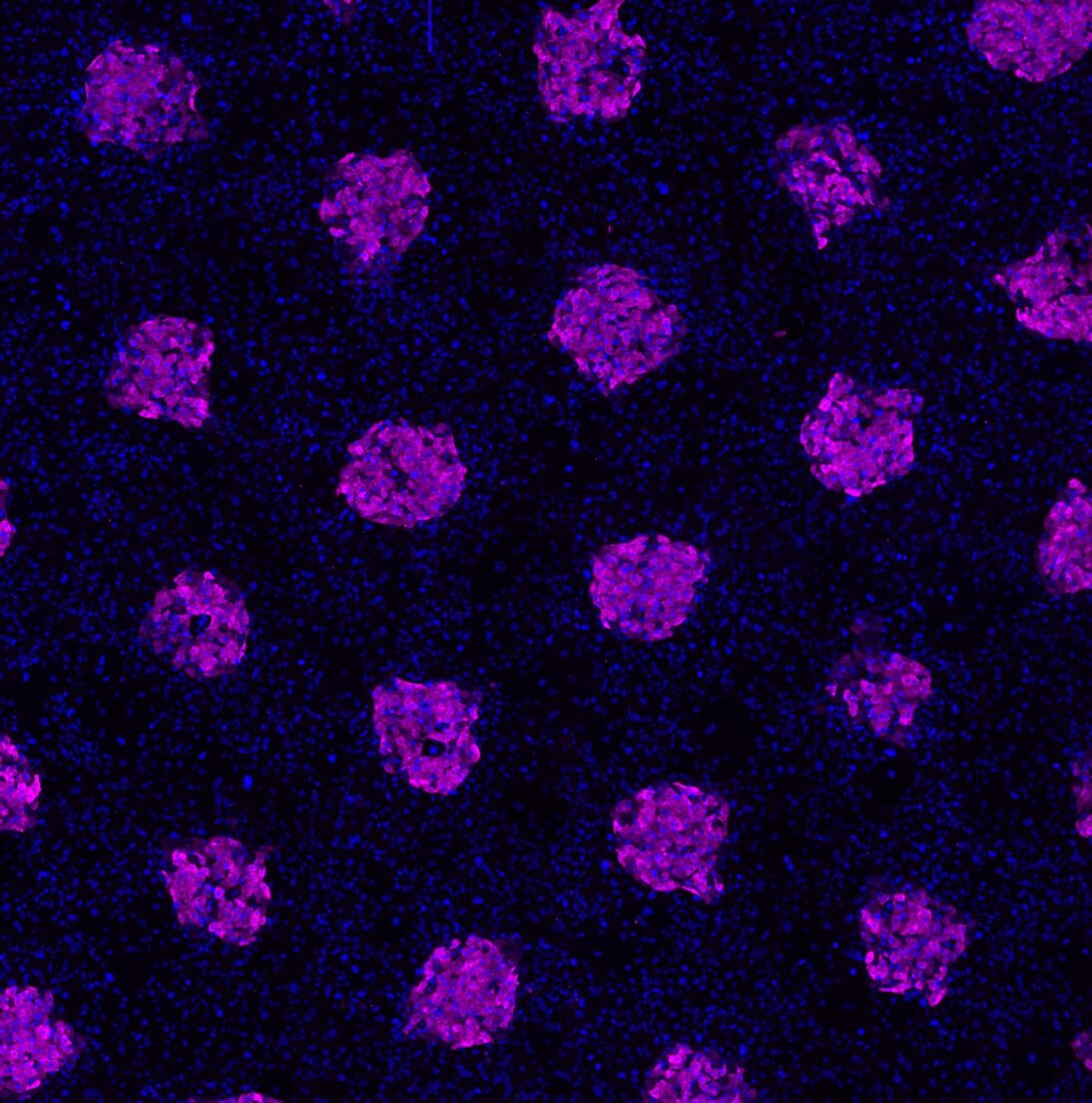 Human hepatocytes stained for metabolic enzyme Cytochrome P450 3A4 (abbreviated CYP3A4) on left.