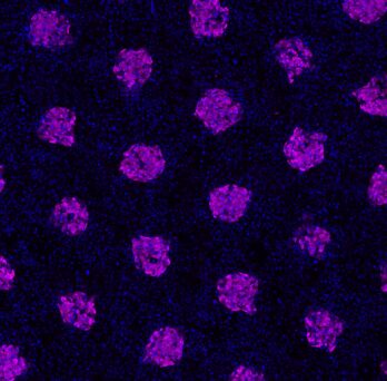 Human hepatocytes stained for metabolic enzyme Cytochrome P450 3A4 (abbreviated CYP3A4) on left. 
