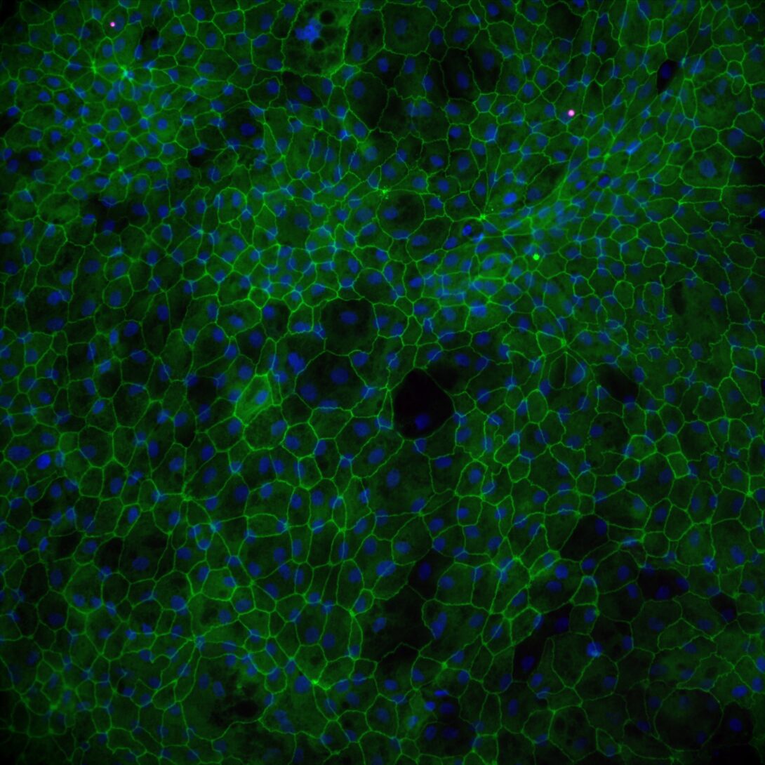 Human intestinal monolayer stained for tight-junction protein ZO-1 in green and cell nuclei in blue.